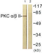 Anti-PKC &#945; antibody produced in rabbit affinity isolated antibody