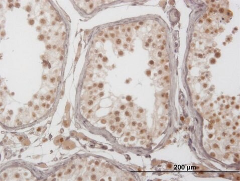 ANTI-PIM1 antibody produced in mouse clone 2C9, purified immunoglobulin, buffered aqueous solution