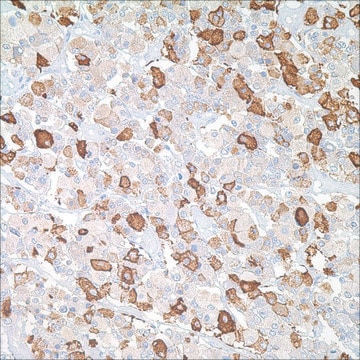 TSH Rabbit Polyclonal Antibody