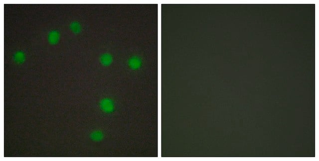 Anti-NKX6.3 antibody produced in rabbit affinity isolated antibody