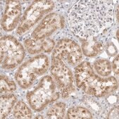 Anti-FDPS antibody produced in rabbit Prestige Antibodies&#174; Powered by Atlas Antibodies, affinity isolated antibody, buffered aqueous glycerol solution