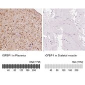 Anti-IGFBP1 antibody produced in rabbit Prestige Antibodies&#174; Powered by Atlas Antibodies, affinity isolated antibody, buffered aqueous glycerol solution