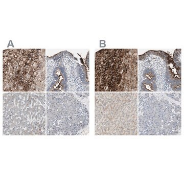 Anti-ALPL antibody produced in rabbit Ab1, Prestige Antibodies&#174; Powered by Atlas Antibodies, affinity isolated antibody, buffered aqueous glycerol solution