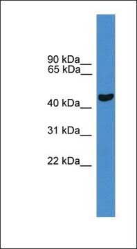 Anti-PARK2 antibody produced in rabbit affinity isolated antibody