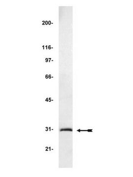 Anti-GFP (Green Fluorescent Protein) Antibody Upstate&#174;, from chicken