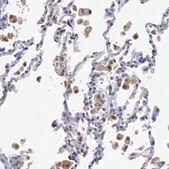 Anti-TYMP antibody produced in rabbit Prestige Antibodies&#174; Powered by Atlas Antibodies, affinity isolated antibody, buffered aqueous glycerol solution