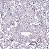 Monoclonal Anti-HER2 antibody produced in mouse Prestige Antibodies&#174; Powered by Atlas Antibodies, clone CL0268, purified immunoglobulin, buffered aqueous glycerol solution