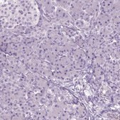 Anti-GABRB2 antibody produced in rabbit Prestige Antibodies&#174; Powered by Atlas Antibodies, affinity isolated antibody, buffered aqueous glycerol solution