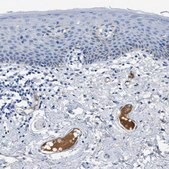 Anti-APOL1 antibody produced in rabbit Prestige Antibodies&#174; Powered by Atlas Antibodies, affinity isolated antibody, buffered aqueous glycerol solution