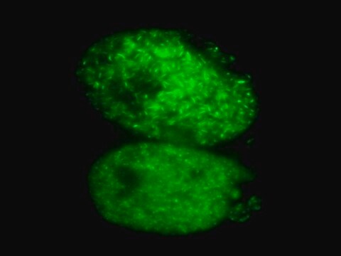 LentiBrite GFP-Rad51 Lentiviral Biosensor