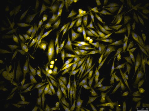 OSUMMER.2 Mouse NRAS-Mutant Melanoma Cell Line