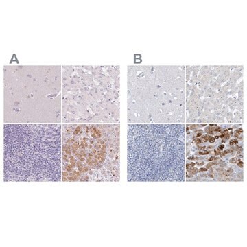 Anti-CTRL antibody produced in rabbit Prestige Antibodies&#174; Powered by Atlas Antibodies, affinity isolated antibody, buffered aqueous glycerol solution