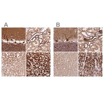 Anti-MT-CO2 antibody produced in rabbit Prestige Antibodies&#174; Powered by Atlas Antibodies, affinity isolated antibody, buffered aqueous glycerol solution