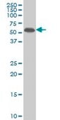 Monoclonal Anti-MAP2K5, (N-terminal) antibody produced in mouse clone 3E10, purified immunoglobulin, buffered aqueous solution