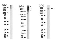 Anti-Collagen IV &#945;2 Antibody, clone 1D9 ZooMAb&#174; Rabbit Monoclonal recombinant, expressed in HEK 293 cells