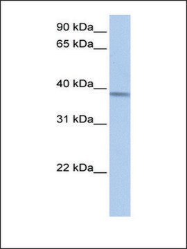 Anti-ACADSB antibody produced in rabbit affinity isolated antibody