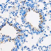 Anti-PPAR gamma antibody produced in rabbit