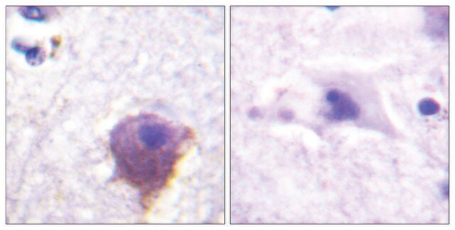 Anti-MAP4 antibody produced in rabbit affinity isolated antibody