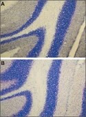 Anti-Endothelin Receptor A antibody produced in rabbit affinity isolated antibody, lyophilized powder