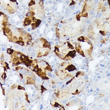 Anti-CRYAB antibody produced in rabbit