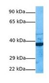 Anti-LDHA antibody produced in rabbit affinity isolated antibody