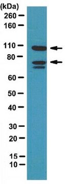 Anti-Amphiphysin II Antibody from rabbit, purified by affinity chromatography