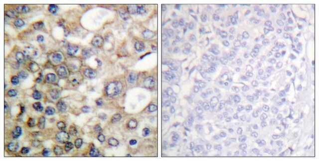 Anti-BTK antibody produced in rabbit affinity isolated antibody