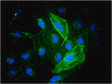 LX-2 Human Hepatic Stellate Cell Line a highly suitable model of human hepatic fibrosis