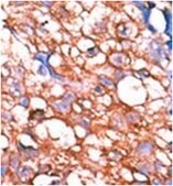 Anti-phospho-HER4 Antibody (Tyr1162) from rabbit, purified by affinity chromatography