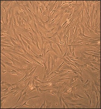 Porcine Pulmonary Artery Smooth Muscle Cells: PPASMC (Cryovial)