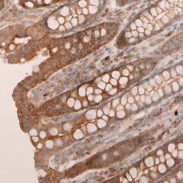 Anti-VSTM2A antibody produced in rabbit Prestige Antibodies&#174; Powered by Atlas Antibodies, affinity isolated antibody, buffered aqueous glycerol solution, Ab2