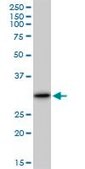 Anti-LGALS3 antibody produced in mouse purified immunoglobulin, buffered aqueous solution
