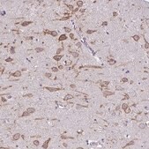 Anti-KCNB1 antibody produced in rabbit Prestige Antibodies&#174; Powered by Atlas Antibodies, affinity isolated antibody, buffered aqueous glycerol solution