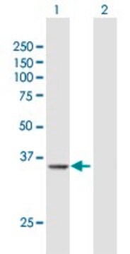 Anti-PRMT6 antibody produced in rabbit purified immunoglobulin, buffered aqueous solution