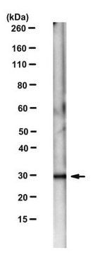 Anti-Tropomyosin-1 Antibody, clone 7F8B8 clone 7F8B8, from rat