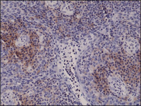 Anti-Integrin alpha 4 antibody, Rabbit monoclonal recombinant, expressed in HEK 293 cells, clone RM268, purified immunoglobulin