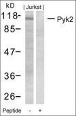 Anti-PTK2B (Ab-402) antibody produced in rabbit affinity isolated antibody