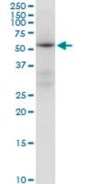 Anti-ALDH4A1 antibody produced in mouse purified immunoglobulin, buffered aqueous solution