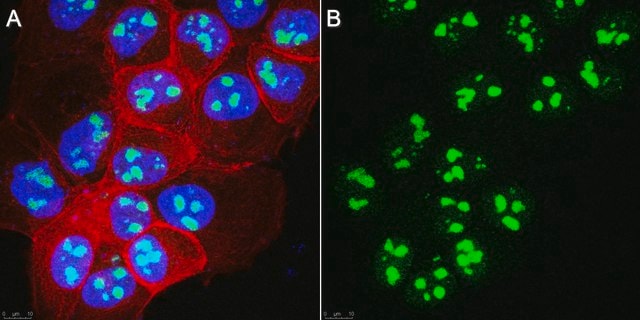 Anti-Nucleoli Antibody, clone 125-10