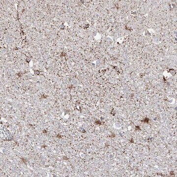 Anti-ARHGEF40 antibody produced in rabbit Prestige Antibodies&#174; Powered by Atlas Antibodies, affinity isolated antibody, buffered aqueous glycerol solution, ab2