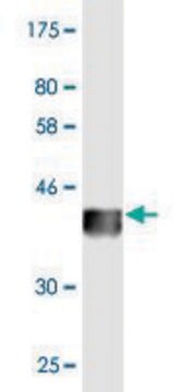 Monoclonal Anti-FDX1 antibody produced in mouse clone 4G5, purified immunoglobulin, buffered aqueous solution