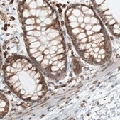 Monoclonal Anti-MTDH antibody produced in mouse Prestige Antibodies&#174; Powered by Atlas Antibodies, clone CL0401, purified immunoglobulin, buffered aqueous glycerol solution