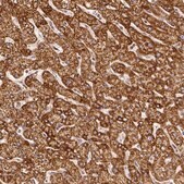 Anti-SDHB antibody produced in rabbit Prestige Antibodies&#174; Powered by Atlas Antibodies, affinity isolated antibody, buffered aqueous glycerol solution