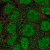 Anti-PRKCB antibody produced in rabbit Prestige Antibodies&#174; Powered by Atlas Antibodies, affinity isolated antibody, buffered aqueous glycerol solution
