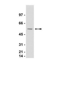 Anti-Calreticulin Antibody Upstate&#174;, from rabbit