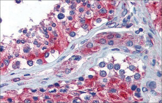 Anti-NPY1R antibody produced in rabbit affinity isolated antibody