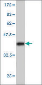 Monoclonal Anti-PPP1R9A antibody produced in mouse clone 6A10, purified immunoglobulin, buffered aqueous solution