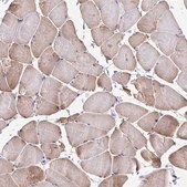 Anti-PERM1 antibody produced in rabbit Prestige Antibodies&#174; Powered by Atlas Antibodies, affinity isolated antibody, buffered aqueous glycerol solution