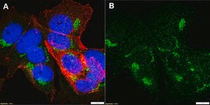 Anti-&#945;-amylase Antibody, clone 1G14 ZooMAb&#174; Rabbit Monoclonal recombinant, expressed in HEK 293 cells