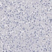 Anti-FABP4 antibody produced in rabbit Prestige Antibodies&#174; Powered by Atlas Antibodies, affinity isolated antibody, buffered aqueous glycerol solution